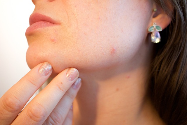 Možnosti konzultace s dermatologem kvůli svědivým pupínkům na chodidlech